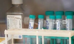 Татарстан нарастил объемы тестирования на коронавирус до 4 тыс. анализов в сутки