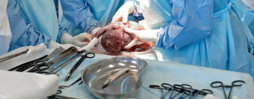 Малыш плавал в крови: в РКБ спасли маму и ребенка, едва не погибших от редкой аномалии