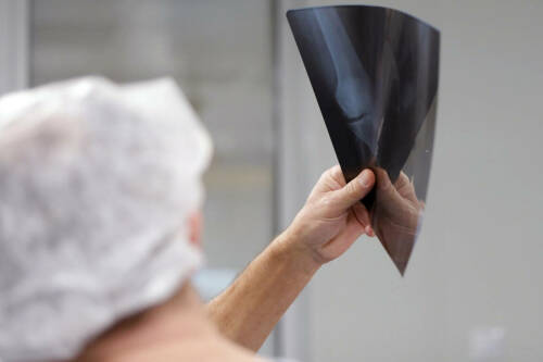 Сегодня артритами страдает около 2% населения планеты, и среди них не только пожилые люди. О том, почему возникает артрит, можно ли заниматься спортом с таким диагнозом, в День осведомленности о ревматоидном артрите, который отмечается 2 февраля, «Татар-информу» рассказал заведующий ревматологическим отделением РКБ Татарстана Рифкат Абдракипов.