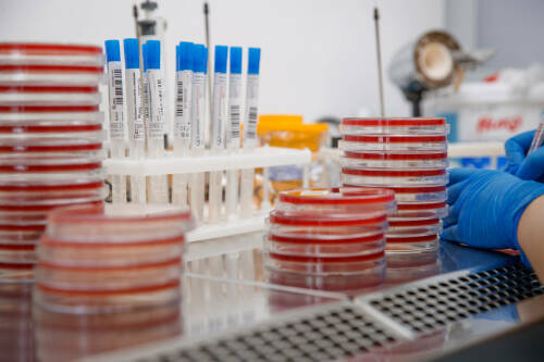 «Вакцины и профилактики нет, главное – скрининг»: врачи о ситуации с гепатитом C в РТ