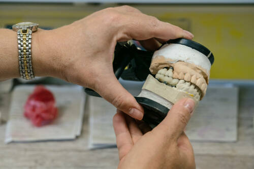 Профессия с художественным вкусом: как работают зубные техники