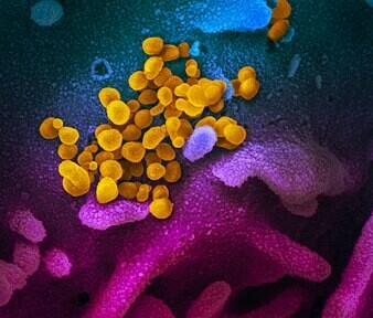 Роспотребнадзор назвал вариант коронавируса «пирола» заразнее предшественников