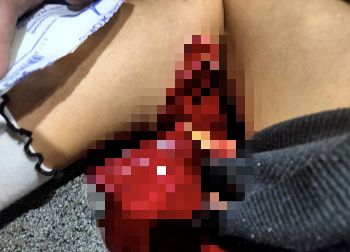 Спасатель-доброволец в РТ помог ребенку, на ногу которому упал спортивный снаряд