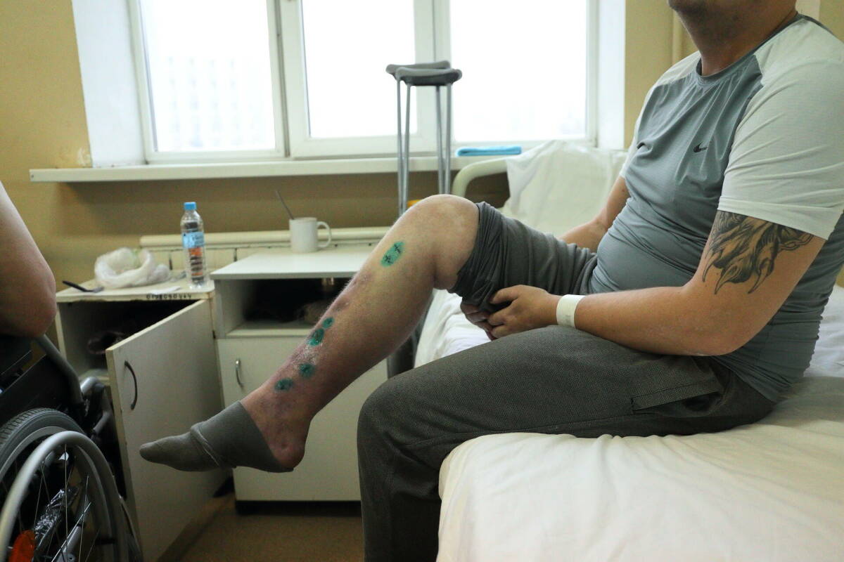 «В каждом госпитале предлагали ампутацию»: как врачи и ученые из РТ спасли ногу бойцу