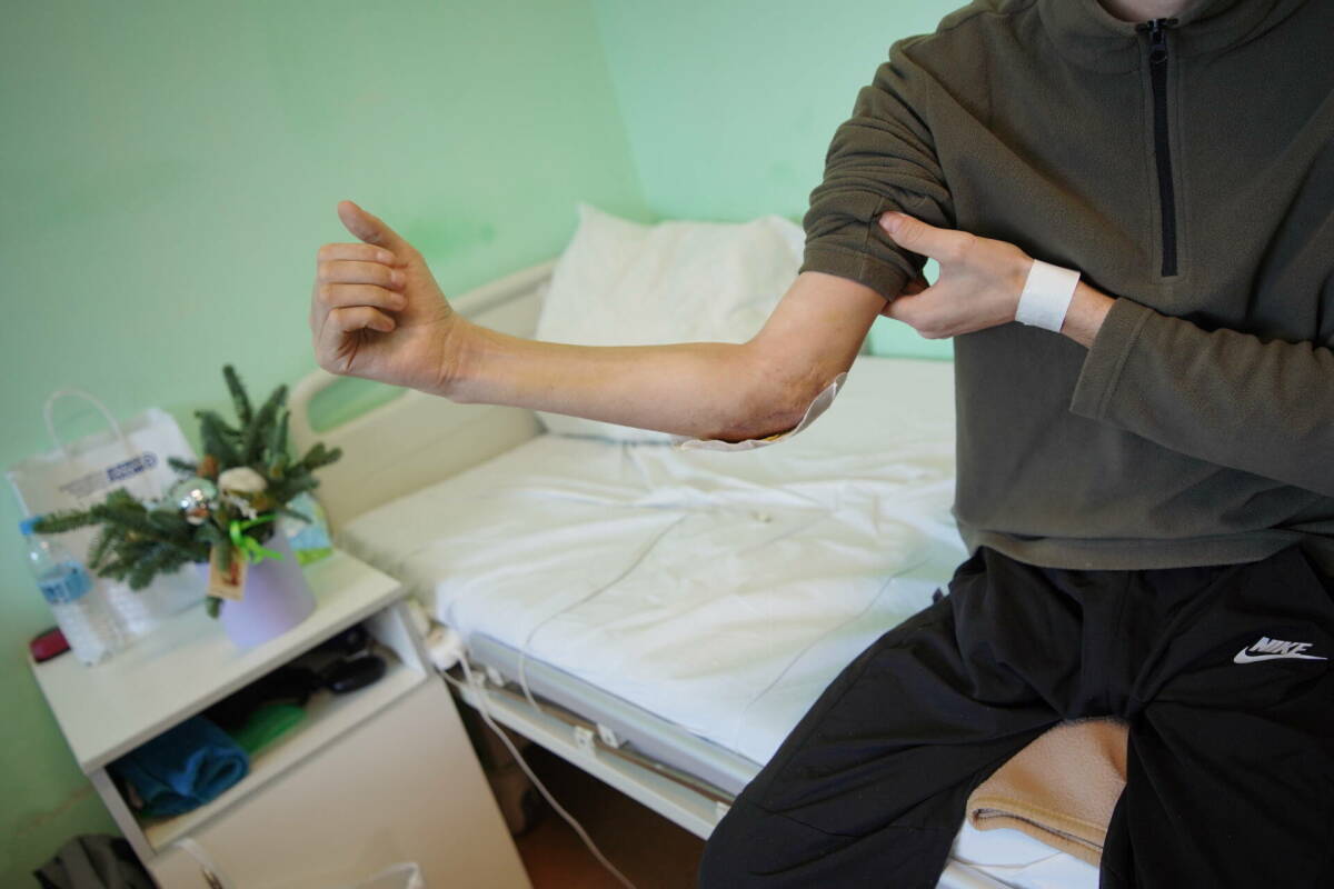 Заниматься привычными делами и вернуться на прежнюю работу сможет боец СВО из Татарстана благодаря врачам РКБ. Вместе с хирургом из Омской области они впервые в республике провели операцию по установке эндопротеза локтевого сустава. После операции об инвалидности пациент РКБ будет вспоминать только из-за записи в своей медкнижке.