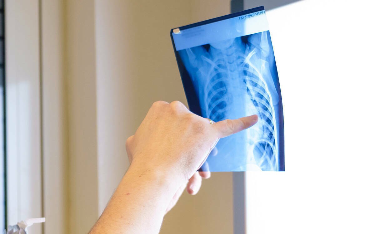 Сколько татарстанцев заболели туберкулезом за год? Как им помогают врачи? Почему, несмотря на их усилия, дети продолжают заражаться? Эти и другие вопросы обсудили на пресс-конференции в «Татар-информе», посвященной Всемирному дню борьбы с туберкулезом.