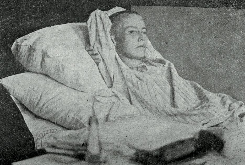 Среди известных фотографий, запечатлевших образ Габдуллы Тукая, есть одна, особенно пронзительная, – поэт в Клячкинской больнице, на смертном одре. Но мало кто знает, что судьба этого кадра куда более драматична. О тех, кто был удален из снимка Иосифа Якобсона, а также об отношениях Тукая и маленького Сайдаша – в материале журнала «Казань».