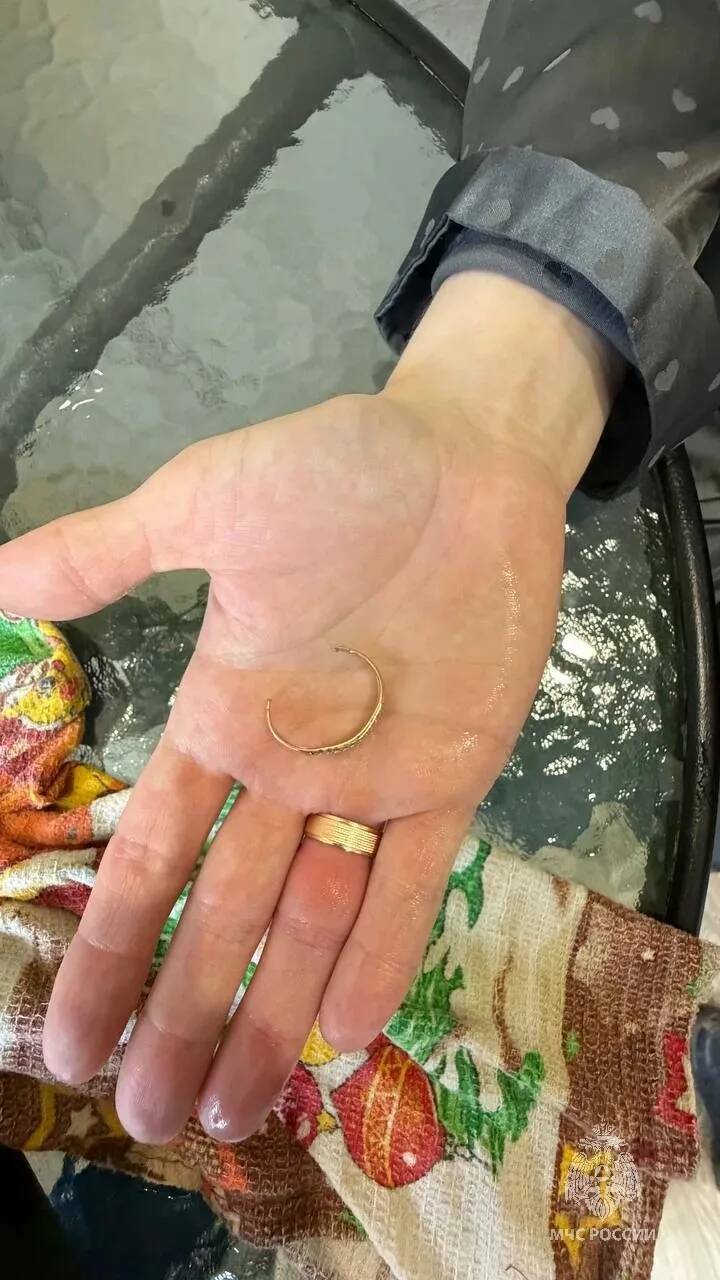 Молодой маме из Казани, пришлось вызывать МЧС, чтобы снять кольцо с пальца