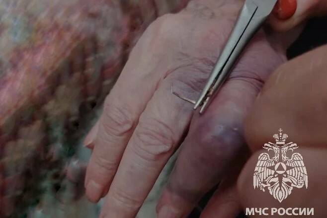 Кольцо, застрявшее на пальце 89-летней жительницы Казани, сняли спасатели
