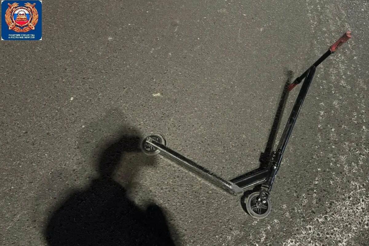 10-летний самокатчик попал под авто в Челнах, он в реанимации