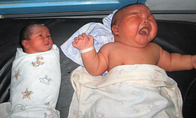Младенец весом почти 9 кг родился в Индонезии
